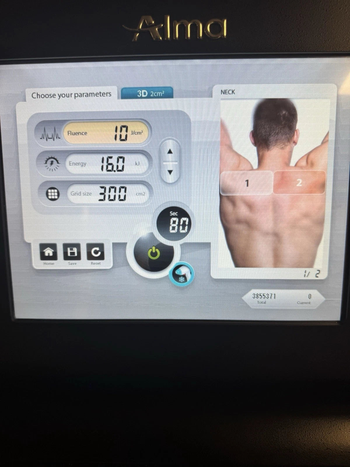 Alma Soprano ICE Platinum w/ 3D Handpiece (755/810/1064nm) And 810nm HP -Low Use
