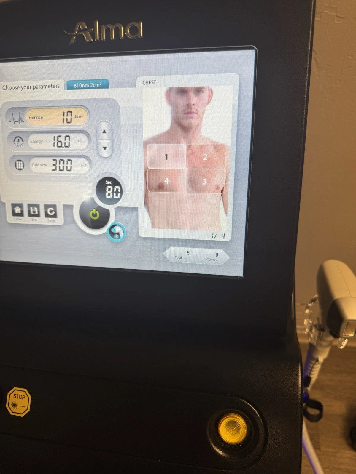 Alma Soprano ICE Platinum w/ 3D Handpiece (755/810/1064nm) And 810nm HP -Low Use